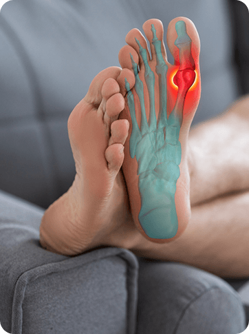 Forefoot Surgeries